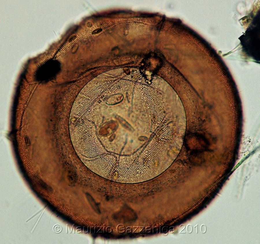 Arcella megastoma